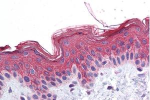 Immunohistochemistry (IHC) image for anti-ADAM Metallopeptidase Domain 17 (ADAM17) (C-Term) antibody (ABIN184721)