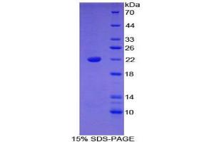 SDS-PAGE analysis of Mouse Bleomycin Hydrolase Protein.
