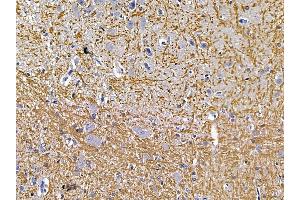 ABIN7094481 and ABIN7098530 at 1/100 staining rat brain tissue by IHC-P. (PLP1 Antikörper  (Internal Region))