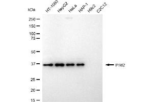 Western blotting analysis using PIM2 antibody (ABIN7800049).