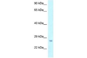 Western Blot showing OSTF1 antibody used at a concentration of 1 ug/ml against THP-1 Cell Lysate (OSTF1 Antikörper  (N-Term))