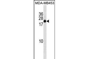 ZN Antibody (C-term) (ABIN1536745 and ABIN2850068) western blot analysis in MDA-M cell line lysates (35 μg/lane). (ZNF747 Antikörper  (C-Term))