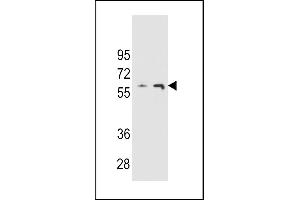 THUM3 Antibody (Center) (ABIN654774 and ABIN2844455) western blot analysis in  and  cell line lysates (35 μg/lane). (THUMPD3 Antikörper  (AA 194-223))