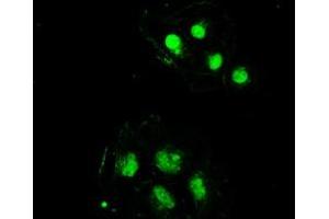 Image no. 16 for anti-Sjogren Syndrome Antigen B (SSB) antibody (ABIN1501146) (SSB Antikörper)