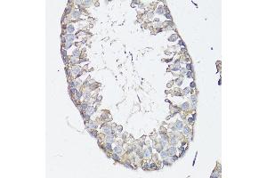 Immunohistochemistry (IHC) image for anti-ATP-Binding Cassette, Sub-Family C (CFTR/MRP), Member 4 (ABCC4) (AA 495-705) antibody (ABIN3023193)