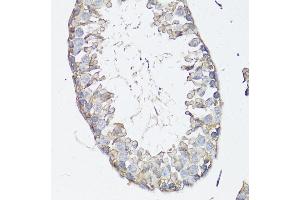 Immunohistochemistry of paraffin-embedded mouse testis using MRP4/ antibody (ABIN3023192, ABIN3023193, ABIN3023194 and ABIN6219432) at dilution of 1:150 (40x lens). (ABCC4 Antikörper  (AA 495-705))