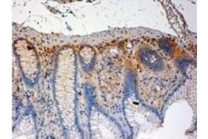 Image no. 3 for anti-C-Src tyrosine Kinase (CSK) (C-Term) antibody (ABIN374096) (CSK Antikörper  (C-Term))
