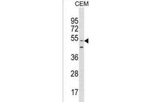 GOLGA6L9 Antibody (N-term) (ABIN1539058 and ABIN2850032) western blot analysis in CEM cell line lysates (35 μg/lane).