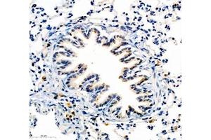 Immunohistochemistry of paraffin embedded rat lung using COLEC12 (ABIN7073552) at dilution of 1:700 (300x lens)