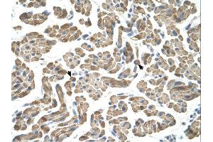 Immunohistochemistry (IHC) image for anti-Sialidase 1 (Lysosomal Sialidase) (NEU1) (Middle Region) antibody (ABIN2781801) (NEU1 Antikörper  (Middle Region))