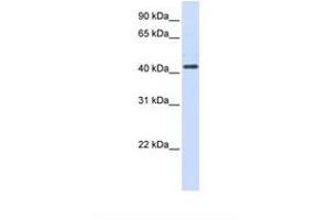 Image no. 1 for anti-Hydroxy-delta-5-Steroid Dehydrogenase, 3 beta- and Steroid delta-Isomerase 2 (HSD3B2) (N-Term) antibody (ABIN6738116) (HSD3B2 Antikörper  (N-Term))