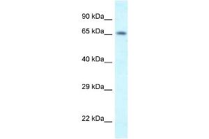 WB Suggested Anti-Shkbp1 Antibody   Titration: 1. (SHKBP1 Antikörper  (N-Term))