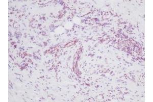 Image no. 3 for anti-Melanoma Inhibitory Activity (MIA) antibody (ABIN464851) (MIA Antikörper)