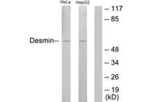 Western blot analysis of extracts from HeLa/HepG2 cells, using Desmin (Ab-60) Antibody. (Desmin Antikörper  (AA 26-75))