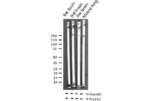 Western Blotting (WB) image for anti-Acetyl-CoA Carboxylase alpha (ACACA) (pSer79) antibody (ABIN6255513)