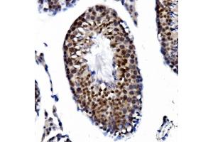 IHC analysis of PRDM14 using anti-PRDM14 antibody (ABIN7603152). (PRDM14 Antikörper  (N-Term))