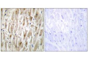 Immunohistochemistry analysis of paraffin-embedded human heart tissue using LIMK2 antibody. (LIMK2 Antikörper  (Internal Region))