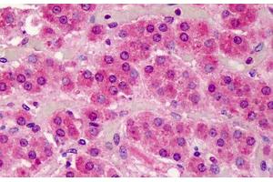 Human Adrenal: Formalin-Fixed, Paraffin-Embedded (FFPE) (SMAD3 Antikörper  (AA 100-150))