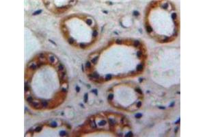 Used in DAB staining on fromalin fixed paraffin-embedded Kidney tissue (Nischarin Antikörper  (AA 1335-1435))