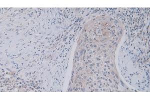 Immunohistochemistry (IHC) image for anti-Junctional Adhesion Molecule 2 (JAM2) (AA 74-250) antibody (ABIN7440674)