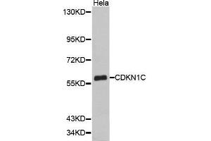 Western Blotting (WB) image for anti-Cyclin-Dependent Kinase Inhibitor 1C (p57, Kip2) (CDKN1C) (AA 1-100) antibody (ABIN1512749) (CDKN1C Antikörper  (AA 1-100))