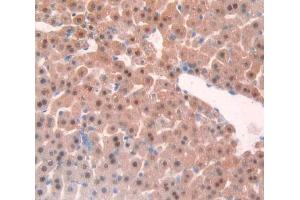 IHC-P analysis of liver tissue, with DAB staining. (TNFRSF1A Antikörper  (AA 239-433))