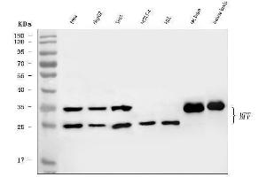 Western blot analysis of MFF using anti-MFF antibody (ABIN7599292).