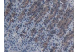 Detection of ABCC11 in Rat Stomach Tissue using Polyclonal Antibody to ATP Binding Cassette Transporter C11 (ABCC11) (ABCC11 Antikörper  (AA 1127-1366))