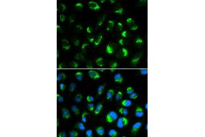 Immunofluorescence analysis of HepG2 cell using SHMT2 antibody. (SHMT2 Antikörper)