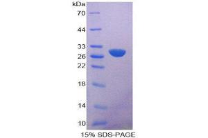 SDS-PAGE (SDS) image for Calcium Independent Phospholipase A2 (PNPLA2) (AA 484-701) protein (His tag) (ABIN2126294)