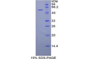 SDS-PAGE analysis of Mouse DARC Protein.