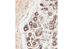 Immunohistochemical analysis of paraffin-embedded human breast tissue using C performed on the Leica® BOND RXm. (ALOXE3 Antikörper  (AA 223-252))