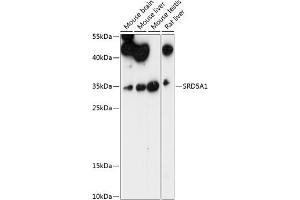 Western blot analysis of extracts of various cell lines, using SRD5 antibody (4787) at 1:1000 dilution. (SRD5A1 Antikörper  (AA 100-200))