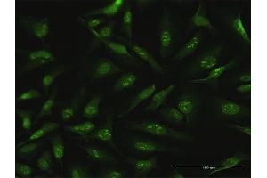 Immunofluorescence of purified MaxPab antibody to CDC6 on HeLa cell. (CDC6 Antikörper  (AA 1-560))