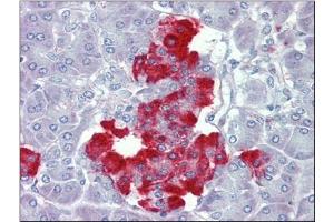 Pancreas, Human: Formalin-Fixed, Paraffin-Embedded (FFPE) (PDGFB Antikörper  (C-Term))