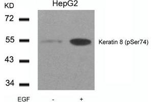 Western blot analysis of extracts from HepG2 cells untreated or treated with EGF using Keratin 8(Phospho-Ser74) Antibody. (KRT8 Antikörper  (pSer74))
