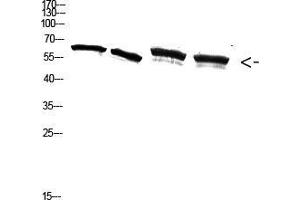 Western Blot (WB) analysis of A549 3T3 293T K562 cells using Antibody diluted at 2000. (NF-kB p65 Antikörper  (pSer536))
