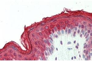 Human, Skin: Formalin-Fixed Paraffin-Embedded (FFPE) (DNAJB1 Antikörper  (AA 74-123))