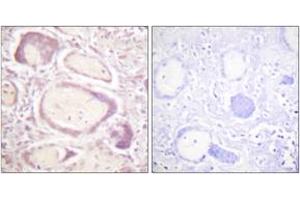 Immunohistochemistry analysis of paraffin-embedded human placenta, using Cyclin B1 (Phospho-Ser147) Antibody. (Cyclin B1 Antikörper  (pSer147))