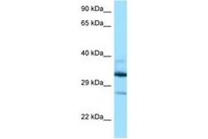Image no. 1 for anti-Deoxyhypusine Hydroxylase/monooxygenase (DOHH) (AA 63-112) antibody (ABIN6748094) (DOHH Antikörper  (AA 63-112))