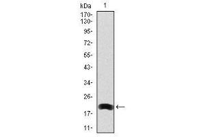 Image no. 1 for anti-Low Density Lipoprotein Receptor-Related Protein 5 (LRP5) antibody (ABIN1499194) (LRP5 Antikörper)