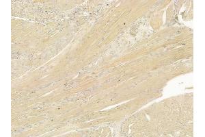ABIN6265947 and ABIN6277546 at 1/100 staining human tongue carcinoma by IHC-P. (VAPB Antikörper  (C-Term))