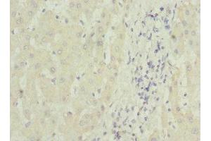 Immunohistochemistry of paraffin-embedded human liver tissue using ABIN7159842 at dilution of 1:100