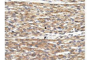 PNPLA3 antibody was used for immunohistochemistry at a concentration of 4-8 ug/ml to stain Myocardial cells (arrows) in Human Heart. (PNPLA3 Antikörper  (C-Term))