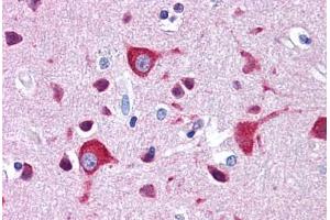 Human Brain, Cortex: Formalin-Fixed, Paraffin-Embedded (FFPE) (ZEB2 Antikörper  (C-Term))