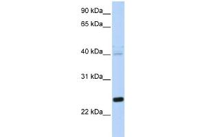 WB Suggested Anti-HSPB8 Antibody Titration: 0.