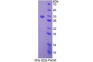 SDS-PAGE (SDS) image for Filamin B, beta (FLNB) (AA 1-237) protein (His tag) (ABIN1981175)