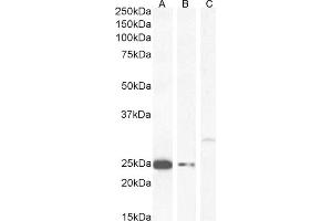 Western Blotting (WB) image for anti-Catechol-O-Methyltransferase (COMT) (N-Term) antibody (ABIN185328)