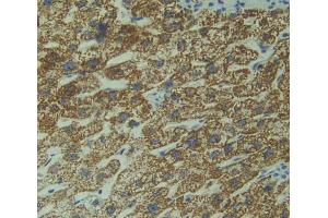 Used in DAB staining on fromalin fixed paraffin- embedded Kidney tissue (DIXDC1 Antikörper  (AA 485-683))