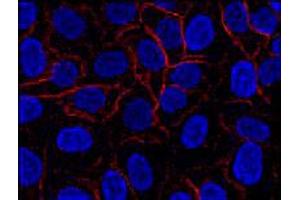 Immunofluorescence staining of AHNAK in HeLa cell line using AHNAK monoclonal antibody, clone EM-09 (Cat # MAB3607 ; red).